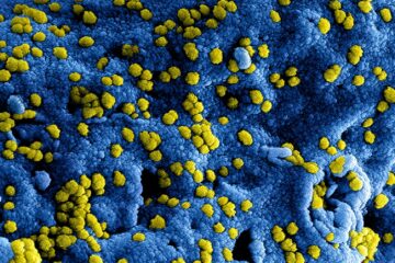 microscopic shot of a virus